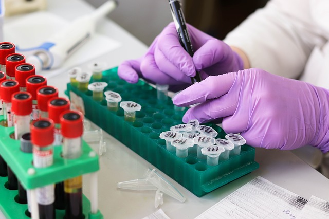 neuroscience lab tech with vials